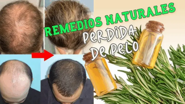 EL MEJOR MEZCLA PARA FAVORECER EL CRECIMIENTO DEL CABELLO Y DETENER SU CAÍDA