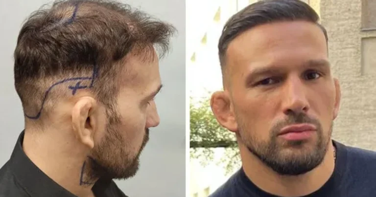 ¿Quieres un Cabello Más Saludable? Descubre el Poder del Aceite de Coco y Cómo Usarlo Correctamente