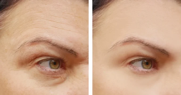 Cómo aplicar la vitamina C en el rostro para un efecto rejuvenecedor