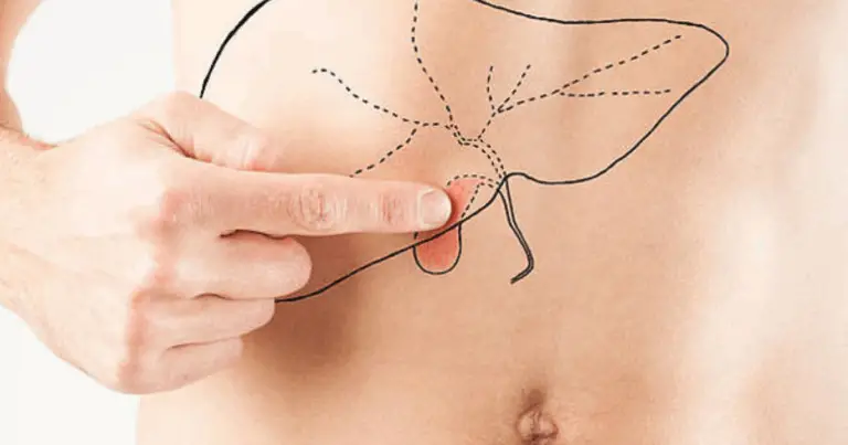 Dolor abdominal: qué significa según la zona, señales de alarma y cómo actuar