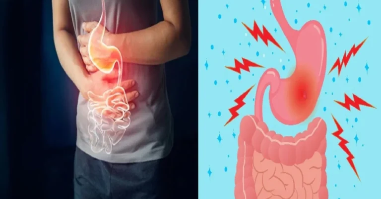 Dieta y alimentos recomendados para combatir el Helicobacter pylori