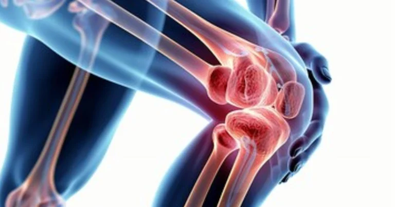 Alivio natural con hojas de laurel en los calcetines