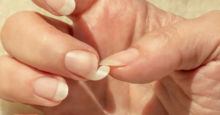 Cómo endurecer las uñas sin usar ajo: 3 remedios eficaces