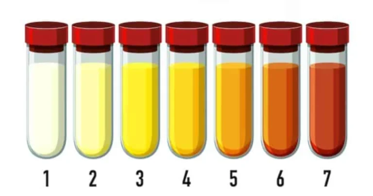 Lo que el color de tu orina revela sobre tu salud