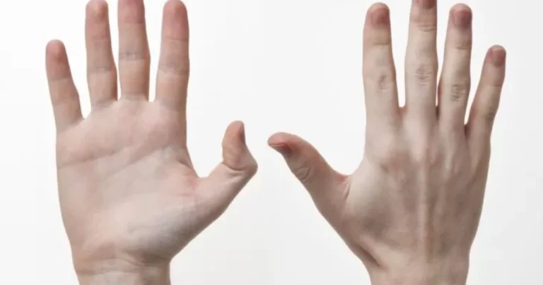 Las manos como mapa del bienestar: una guía completa