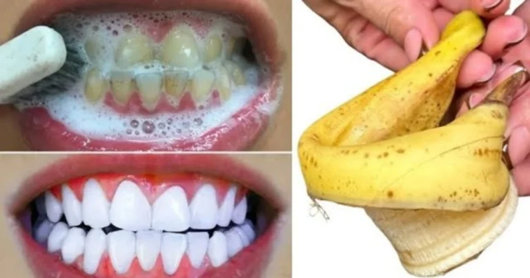 Blanquea tus dientes de forma natural con cáscara de plátano: guía completa y segura