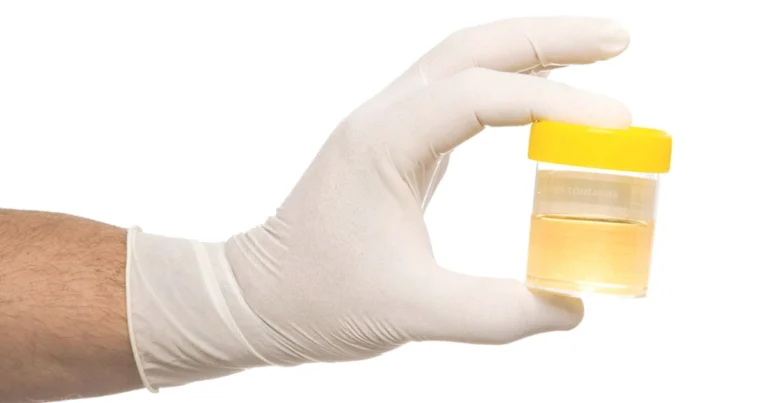 El Color de la Orina: Qué Significa Realmente y Cómo Interpretarlo Correctamente