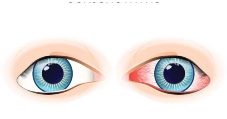 Ojos saludables: hábitos diarios para prevenir la fatiga visual y cuidar tu visión